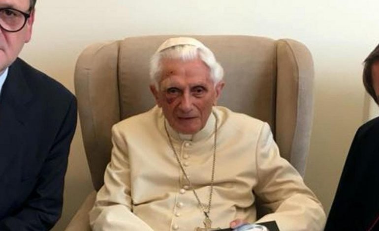 FOTO/ Papa i dorëhequr Bendikti XVI, në publik me sy të nxirë!