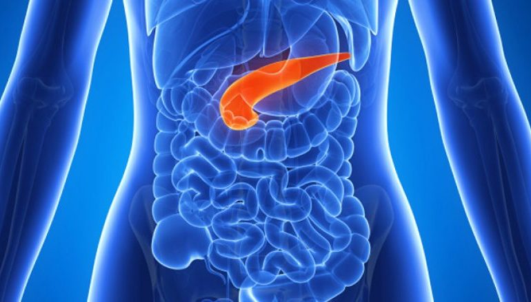 Pesë simptomat e kancerit në pankreas