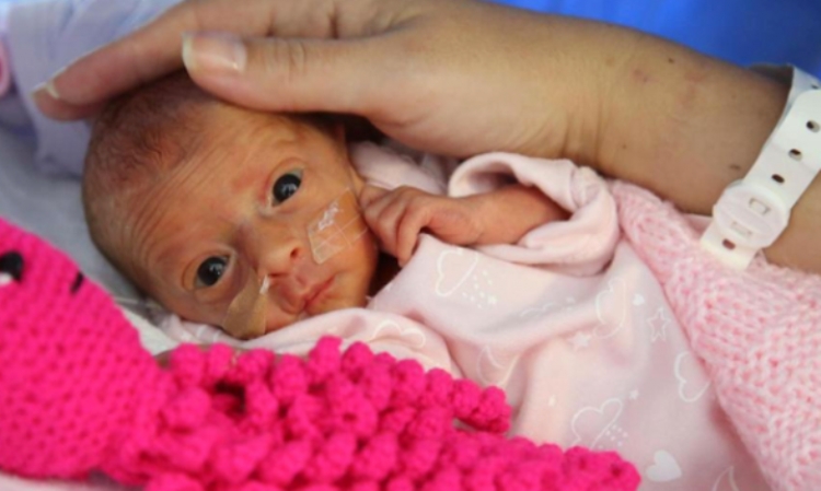 Mrekullitë ndodhin! Foshnja lindi 500 gram, por… (Foto)