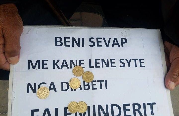 Lypte në Tiranë për t’i shpëtuar verbërisë, nuk do ta besoni se si ia del ai (Foto)