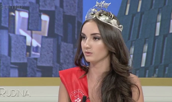Shokon Miss-i shqiptar: Modelingu është më i rëndësishëm se shkolla