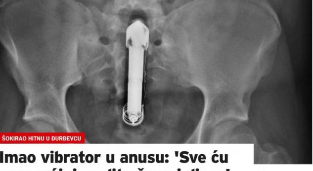 Shok: Burrit i ngelet vibratori në anus, gruaja thërret emergjencën