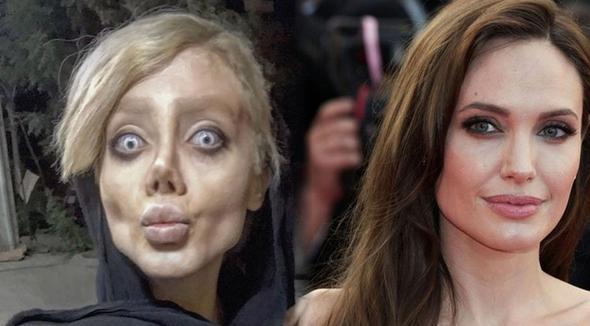 FOTO/ E fiksuar pas Angelina Jolie, nuk do ta besoni si u katandis pas dhjetëra operacioneve