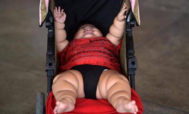 Foshnja 10 muajshe peshon 62 kg/ Mjekët: Nuk e shpjegojmë dot (Foto)