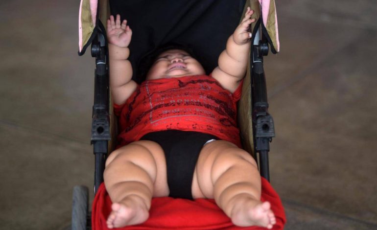 Foshnja 10 muajshe peshon 62 kg/ Mjekët: Nuk e shpjegojmë dot (Foto)