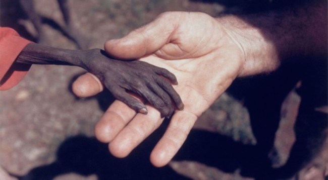 Në këtë vend çdo ditë vdesin nga uria rreth 130 fëmijë