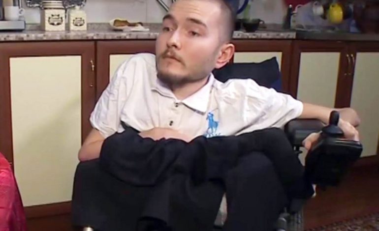E pabesueshme/ Realizohet me sukses transplanti i parë i kokës