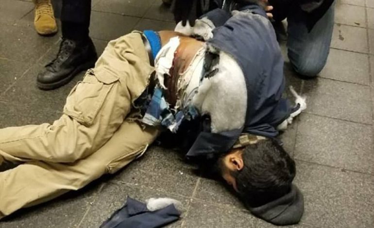 SULMI NË SHBA/ Agresori kishte ndërtuar bombën me sheqer dhe bateri të vogla. Kishte inat Krishtlindjet (FOTO)