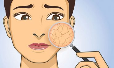 Dy trajtime natyrale për të hidratuar lëkurën e thatë të fytyrës pas dushit