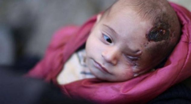 SIMBOLI I MASAKRËS/ Nëna iu vra i biri humbi syrin gjatë luftës