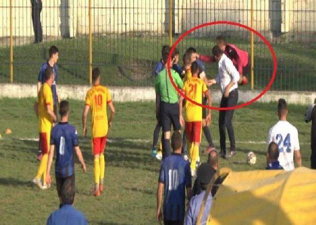 SPECIALE/ ‘Përgjakja’ e futbollit shqiptar, të gjitha rastet e dhunës në kategoritë e ulëta