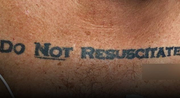Tatuazhi i pacientit thoshte “Mos më ringjallni”, por ja çfarë bënë mjekët