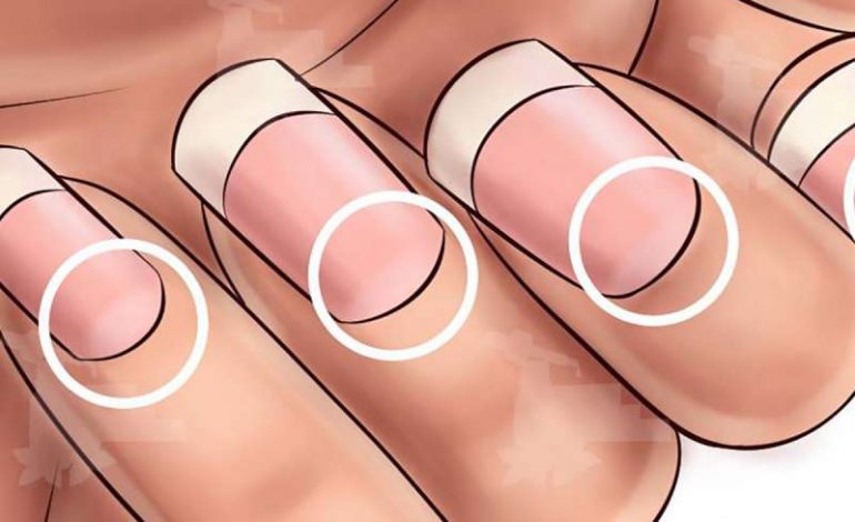 Kjo është ajo çfarë thonjtë paralajmërojnë për ju! Plakje organesh, inflamacion ose më keq akoma…
