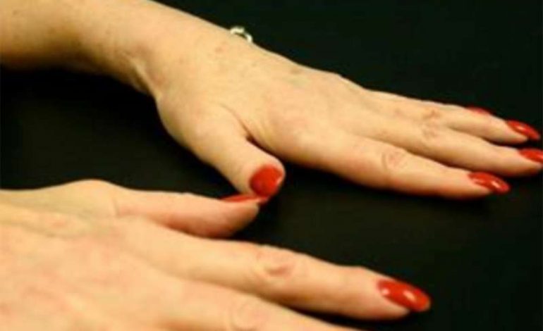 Mungesa e vitaminës D shkakton dhimbje koke, tension të lartë, madje edhe …