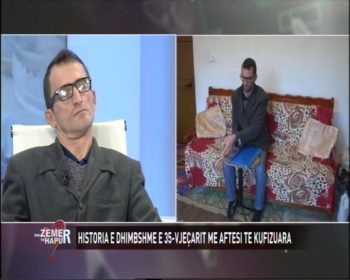 I riu me aftësi të kufizuara përlotet ‘live’: Jam paragjykuar gjithë jetën, dua veç të punoj