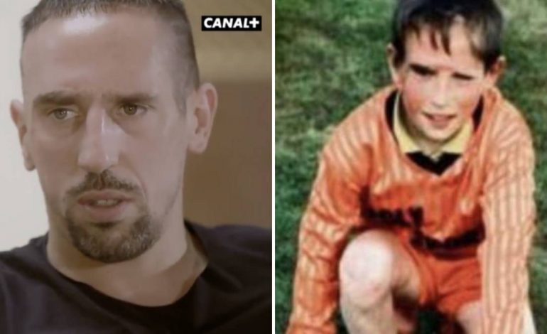 Nga murator në yll futbolli, Ribery tregon fëmijërinë e vështirë dhe shenjën në fytyrë