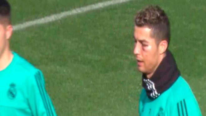 Real Madrid, Ronaldo shfaqet në stërvitje me syrin e nxirë e të enjtur (VIDEO)