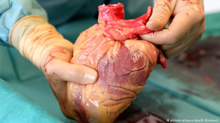 TRANSPLANTIMI I ORGANEVE/ Rrëfehet vajza e 65-vjeçarit: Si më vdiq babai nga hemoragjia