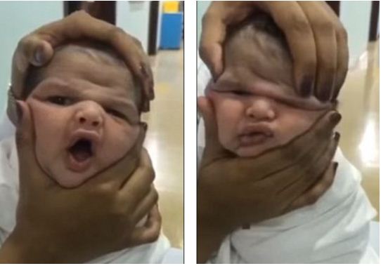 Luanin me kokën e fëmijës së sapolindur, shikoni çfarë u ndodhi infermiereve (Video)