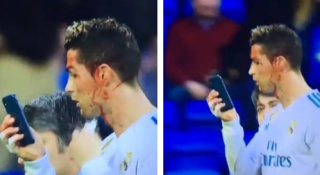 FOTO/ Karikatura e ditës: Ronaldo i mbuluar me gjak