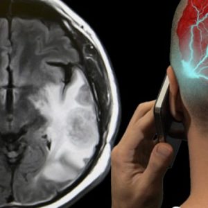 Kujdes nga celulari! Shkakton ndryshime në metabolizmin e trurit dhe…