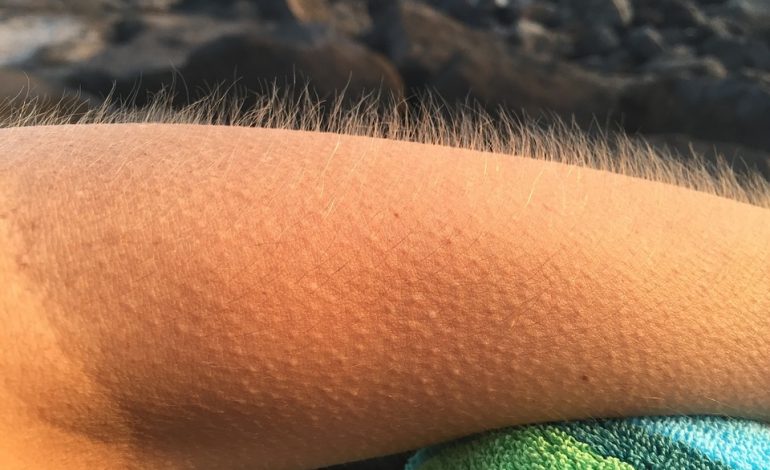 Nëse muzika të rrënqeth mishin, atëhere ti je …