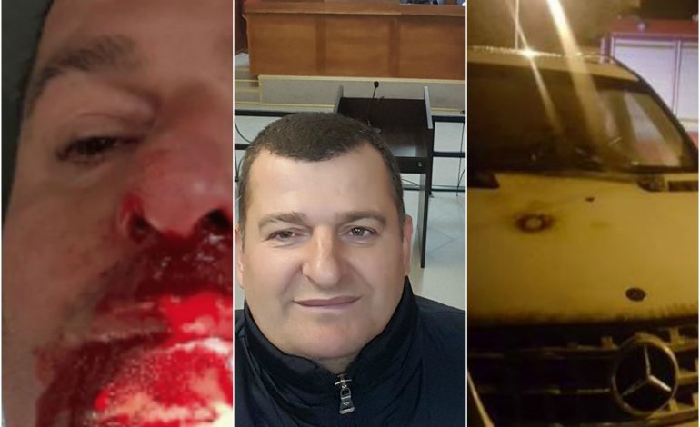 I DOGJËN MAKINËN/ Flet BIZNESMENI: Lidhet me ato që kam shkruajtur në “Facebook”. Biçikleta e autorit…