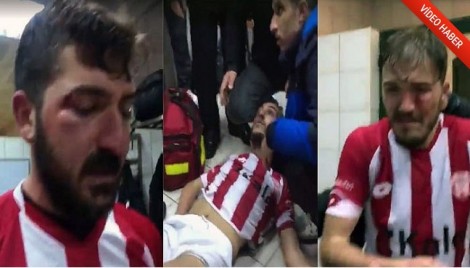 E RËNDË/ Tifozët rrahin futbollistët miq, 4 lojtarë përfundojnë në spital me dëmtime të rënda (VIDEO)