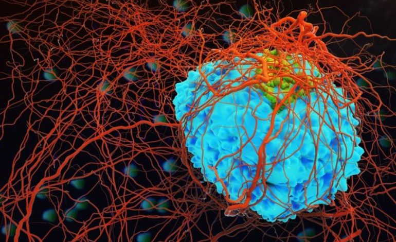 12 rregullat “E ARTA” të parandalimit të kancerit!