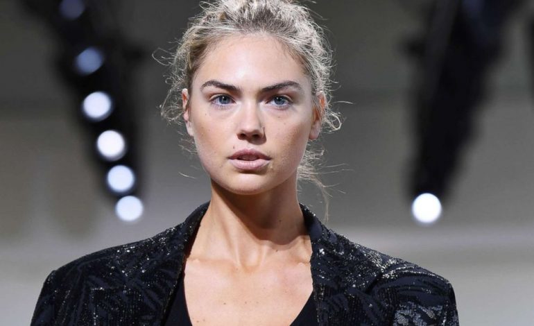 Për herë të parë, Kate Upton nuk duket aq bukur (FOTO)