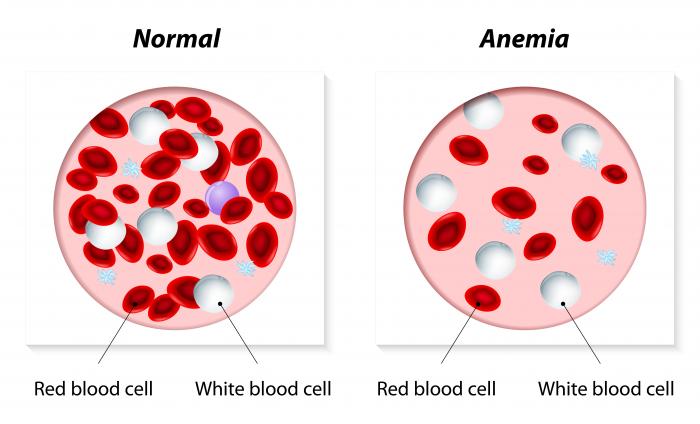 Vuani nga anemia? Këto janë disa ushqime që duhet të konsumoni për të përmirësuar gjendjen tuaj.