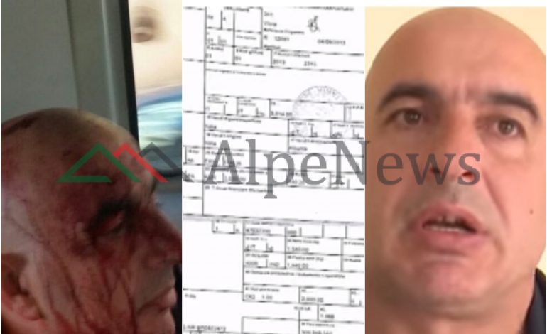 E MASAKRUAN ME LEVË/ Si lindi KONFLIKTI midis Biznesmenit dhe Prokurorit. E kishte denoncuar për… (VIDEO)