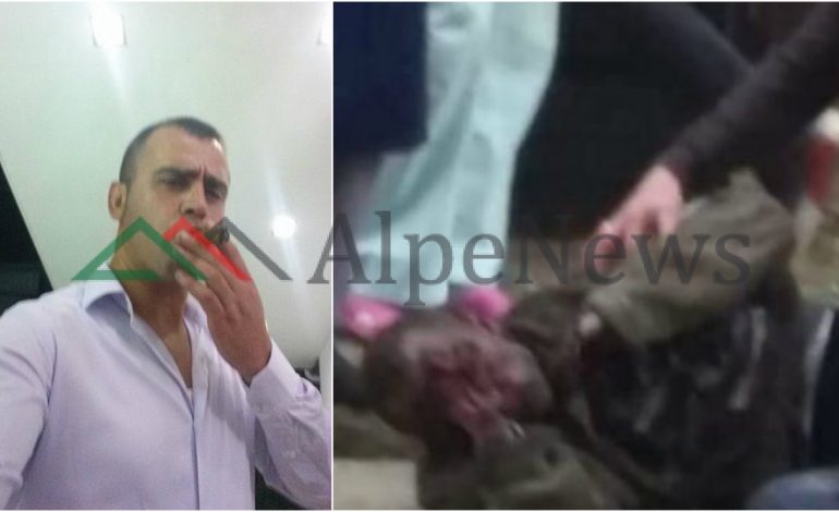 MINA ME CELULARË/ 2 mijë € një bombë! Çfarë u gjet tek dyqani ku ndodhi shpërthimi (DETAJET)