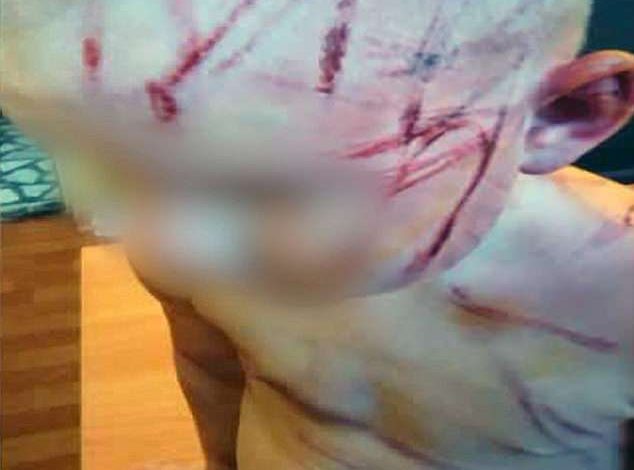 S’diti të numëronte, njerku e rrahu me rrip 4 vjeçaren në Rusi (Video/Foto)