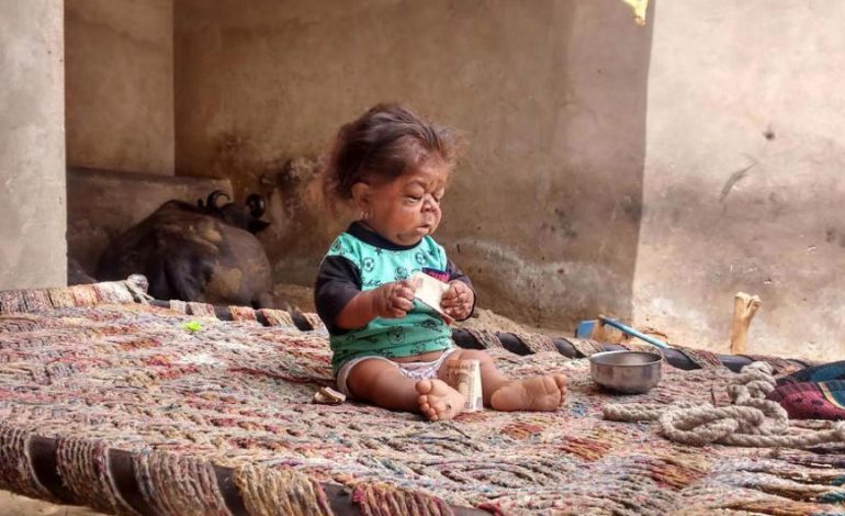 “Mishërim i Perëndisë!” 23 vjeç në trupin e një fëmije (FOTO)