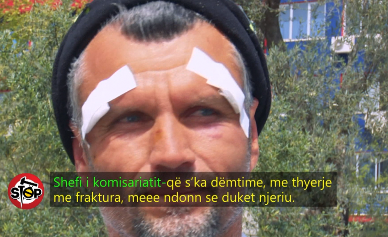 SKANDALI/ Qytetari denoncon DHUNËN, autorët të lirë. Shefi i komisariatit: Atë ditë ishim pushim… (VIDEO)
