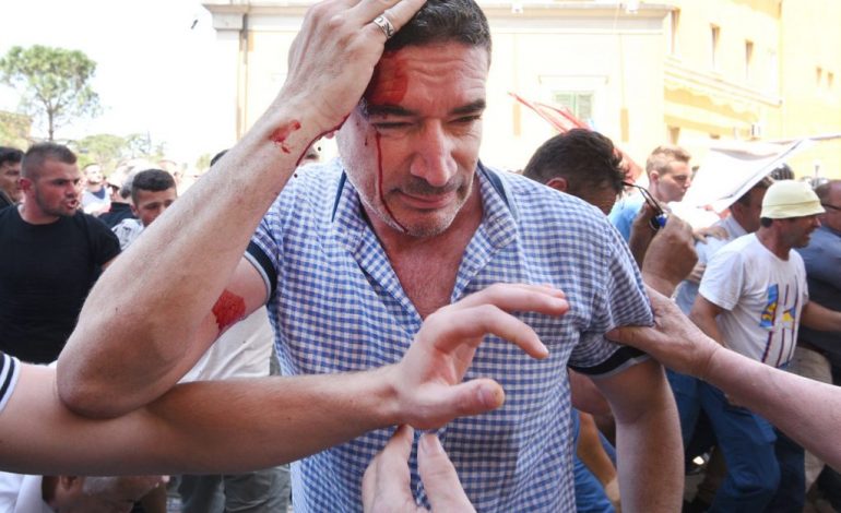 “U DHUNUA NË PROTESTË”/ Kryeredaktori i RD: Më goditën policët egërsisht me shkop gome…