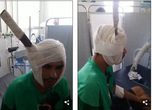 VIDEO/ Pamje të frikshme pas sherrit në burg, të dënuarit i ngulin thikën në kafkë