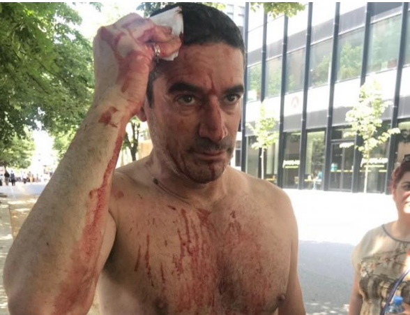 DALIN PAMJET/ Momenti kur kryeredaktori i RD goditet në kokë. Nga protestuesit apo policët… (VIDEO)
