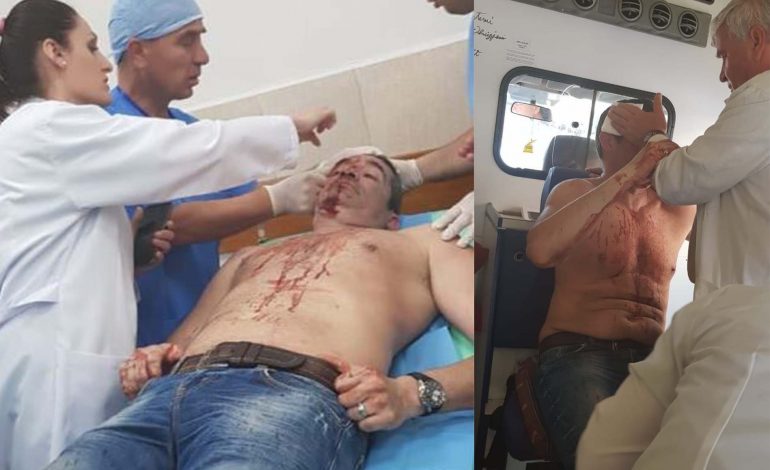 Dëshmia e kryeredaktorit të RD: Si më goditi policia me shkop gome në kokë, kam 10 qepje…