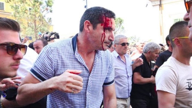 GAZETARI U GJAKOS NË PROTESTË/ Kolegët reagojnë: E papranueshme dhe duhet dënuar… (FOTO)