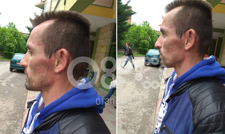 Dhunuan 34-vjeçarin në komisariat/ Procedohen penalisht dy efektivë të policisë (VIDEO)