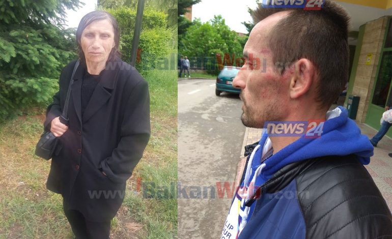 E RËNDË/ Korçari tregon TORTURAT e policisë së Korçës: Më rrahën derisa humba… (FOTOT)