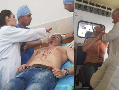 PROTESTA/ Kryeredaktori i RD: Mua kokën ma çau shkopi prej hekuri, do ta denoncoj policinë… (VIDEO)