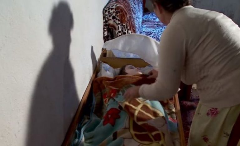 E TRISHTË/ Historia e DHIMBSHME e 14-vjeçarit që peshon vetëm 14 kg… (VIDEO)