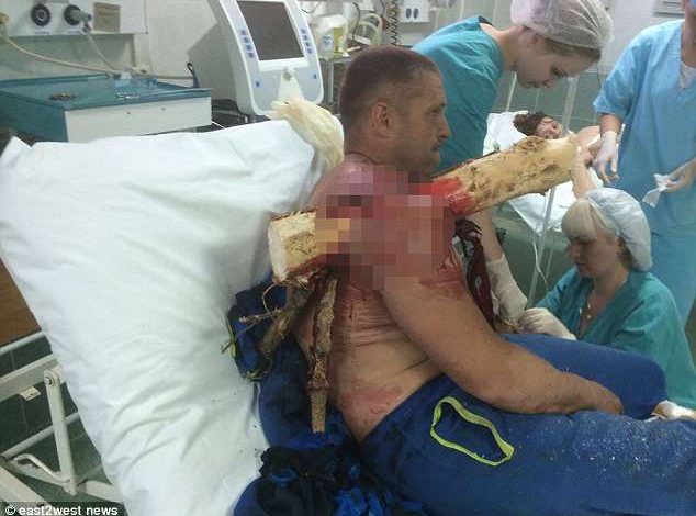 PAMJE TE RENDA/ Incidenti i frikshëm, parashutistit i ngulet një copë druri në shpatull (FOTO)