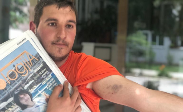 “Më RRAHËN në komisariat”/ Policia REAGON pas denoncimit të 28-vjeçarit nga Pogradeci: Ai ka…