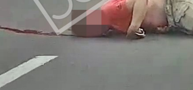 AKSIDENT I FRIKSHËM NË TIRANË/ Burri “lahet” NË GJAK pranë QSUT-së… (PAMJE TË RENDA)