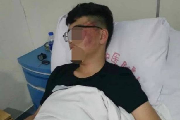E RENDE/ Djali po bënte zhurmë në klasë, dhe mësuesja e godet me… (VIDEO)