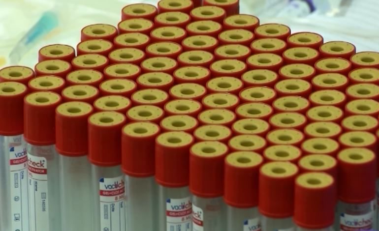 Shkencëtarët australianë zbulojnë testin e gjakut që vëren kanceret e lëkurës